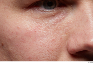 HD Faec Skin Doe Irish eye face nose skin pores…
